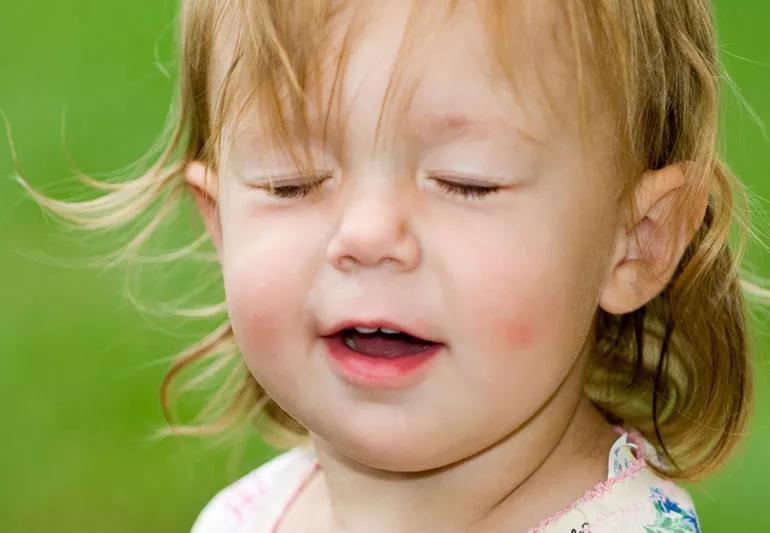 Toddler caught mid blink while laughing.