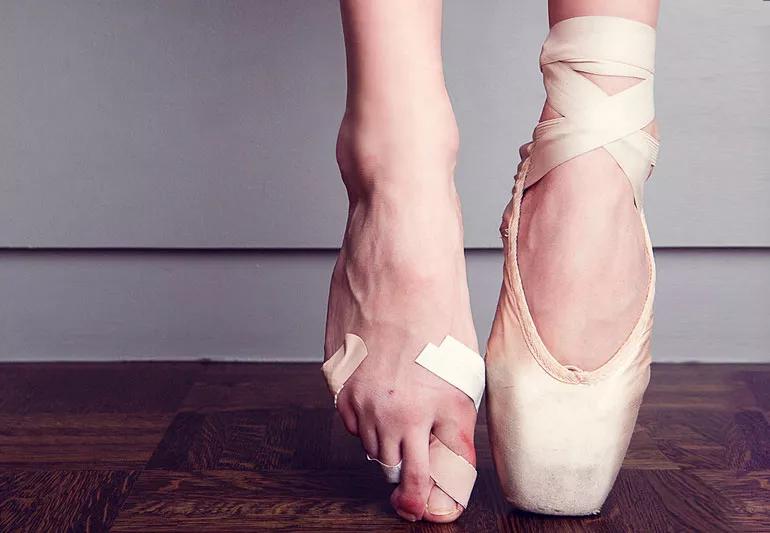 Closeup of ballerina's feet, one foot bruised with bandaid and the other still in its point slipper.