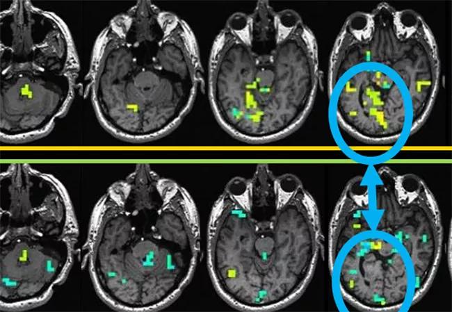 17-NEU-4473-Jones-fMRI-650&#215;450