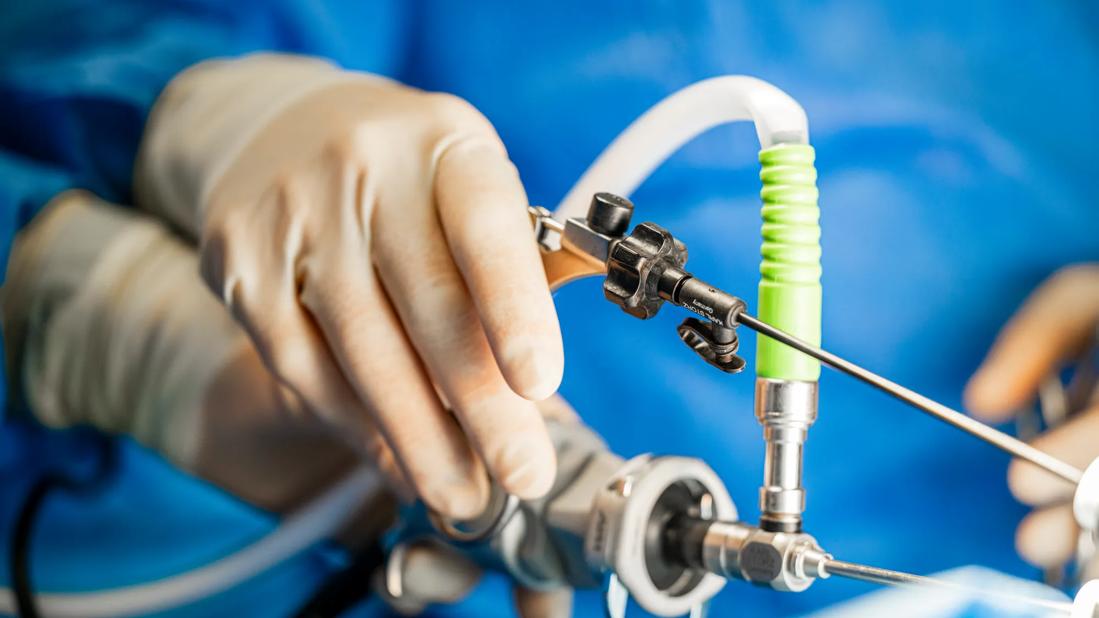 C-section surgery