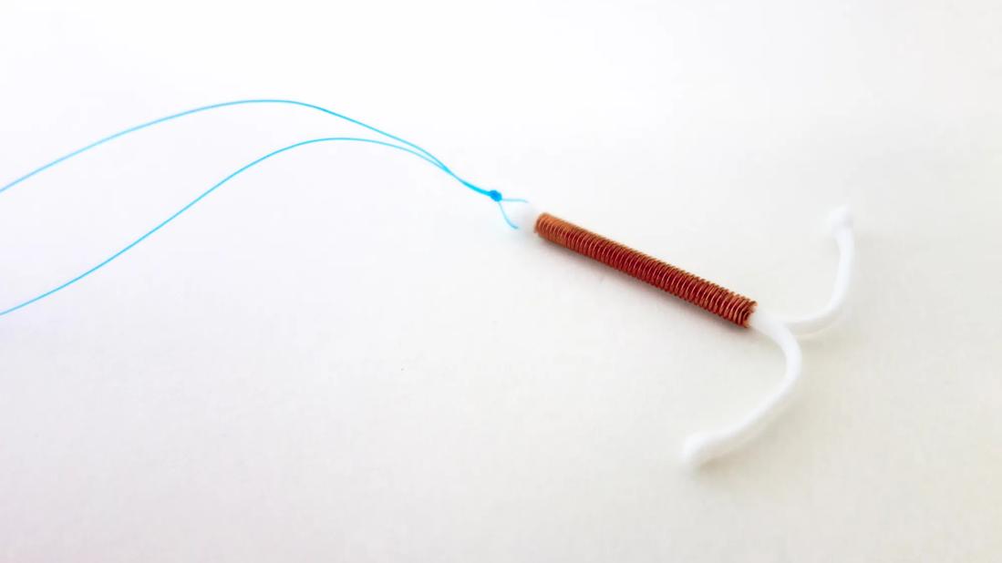 A copper intrauterine device (IUD)