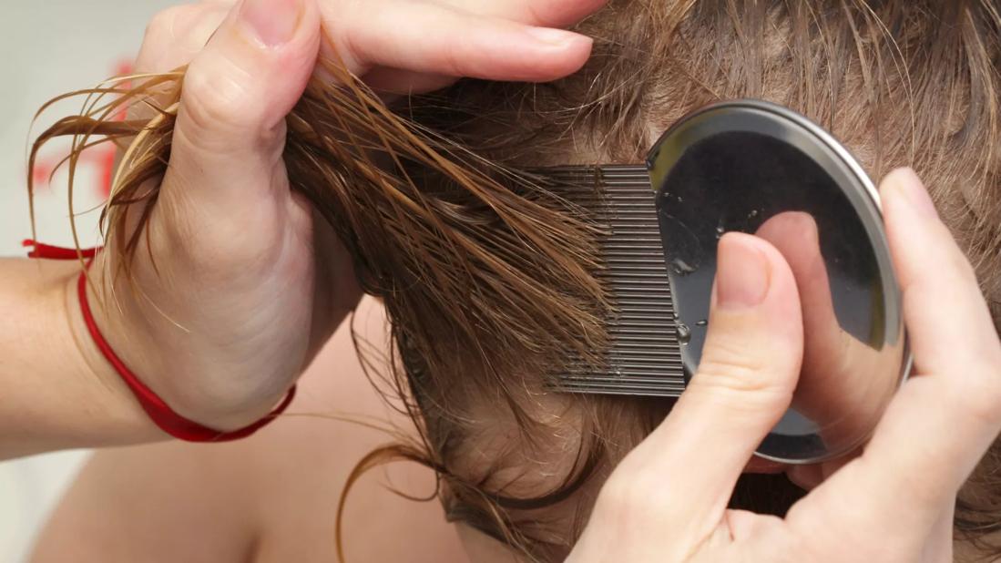 parent checking child's hair for lice