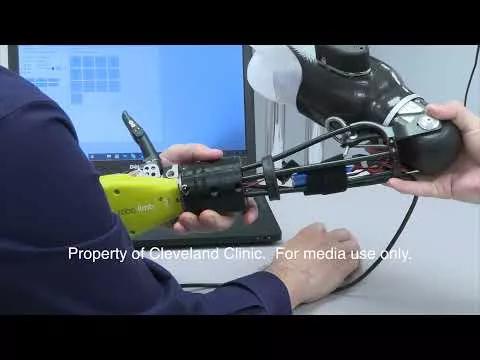 FOR MEDIA Bionic Arm Advances Provide More Natural Function Study Shows