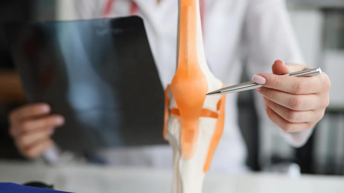 Healthcare provider holding X-ray in one hand, pointing to a model of a bone and joint with the other