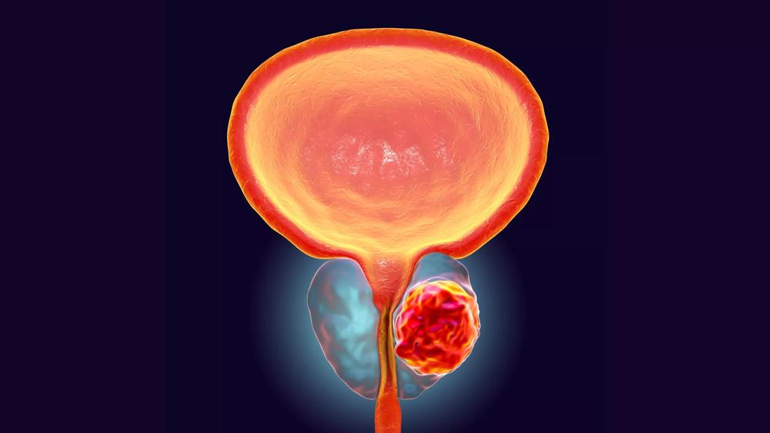 Cleveland Clinic Researchers Identify New Drug Target for Treating
