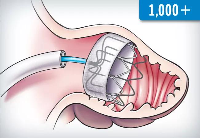 21-HVI-2489560-Watchman 1000+_650x450