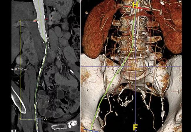ENCYCLOPAEDIA of OCCLUSION【裁断済】 Force Distribution on Occlusal Splints Using T-Scan Occlusal