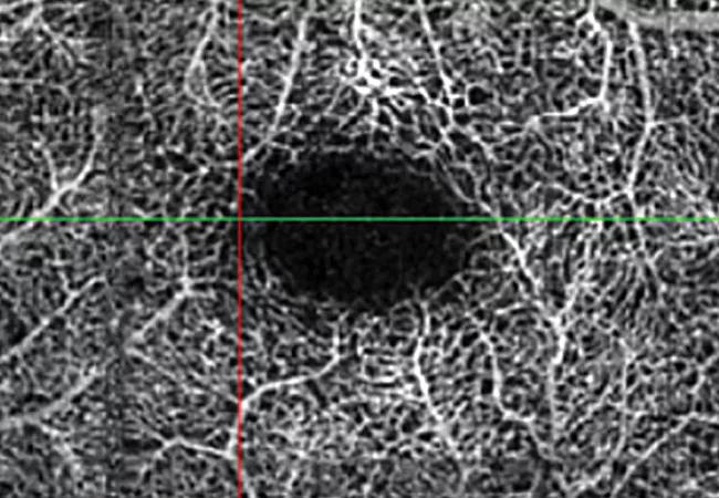 16-eye-1562-octa-cqd-650&#215;450