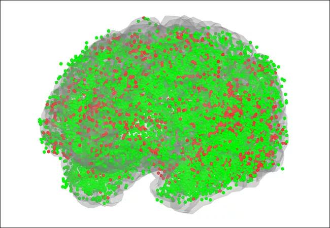 21-NEU-2183759_brain-mapping-in-epilepsy_650x450