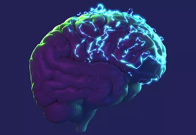 19-NEU-518-epilepsy-brain-650&#215;450