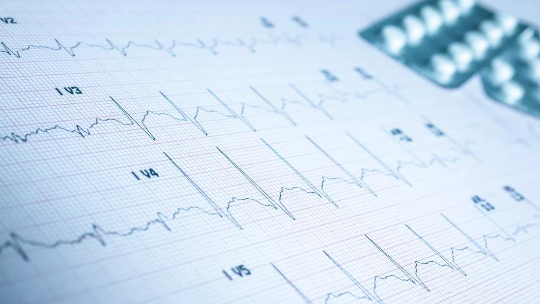 Cleveland ClinicLed Trial Finds That Increasing Salt Intake Does Not