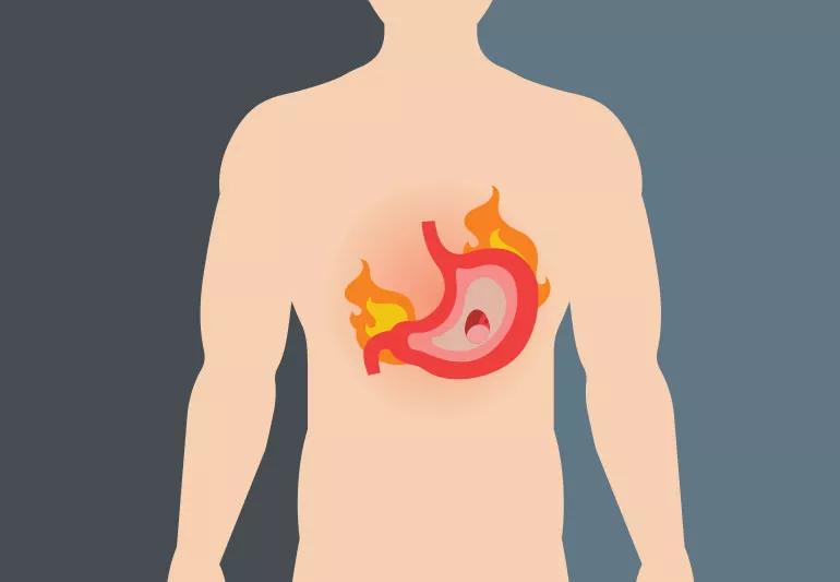 Illustration of stomach on fire in man's body