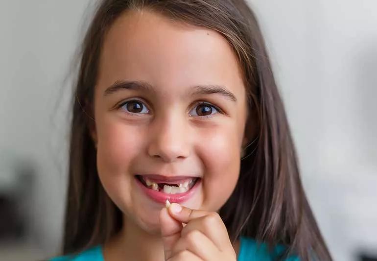 kid showing a tooth that was pulled