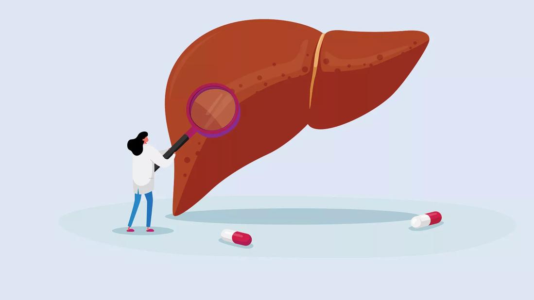 An illustration of a person looking at a liver with a magnifying glass