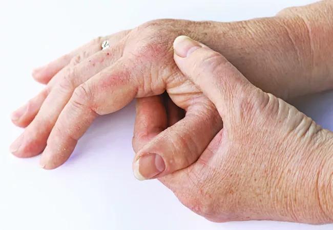 man with painful joints in hand