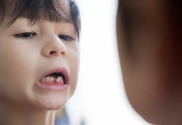 child with loose tooth showing parent