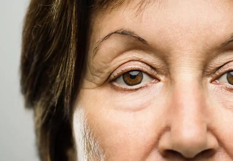 older woman closeup of her eyelids and wrinkles