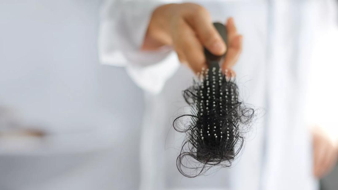 Hair Loss in Women: When Should You Worry?