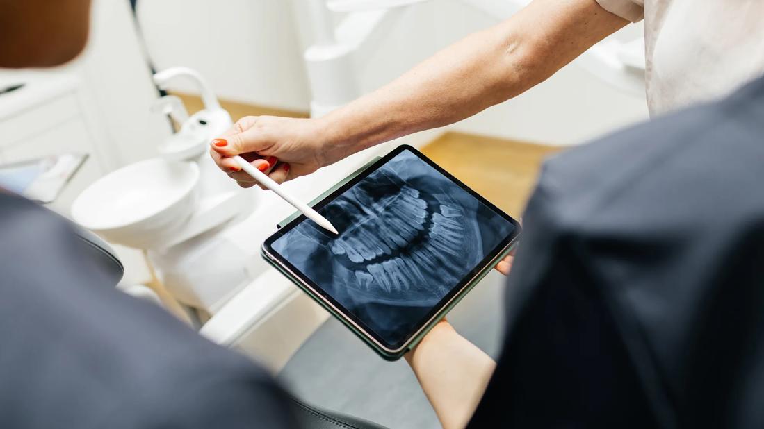 Dental care provider holding tablet showing X-ray image, pointing out part of the