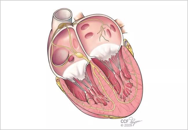 Beyond the Binary in Atrial Fibrillation: AHA Statement Calls for Focus on AF Burden