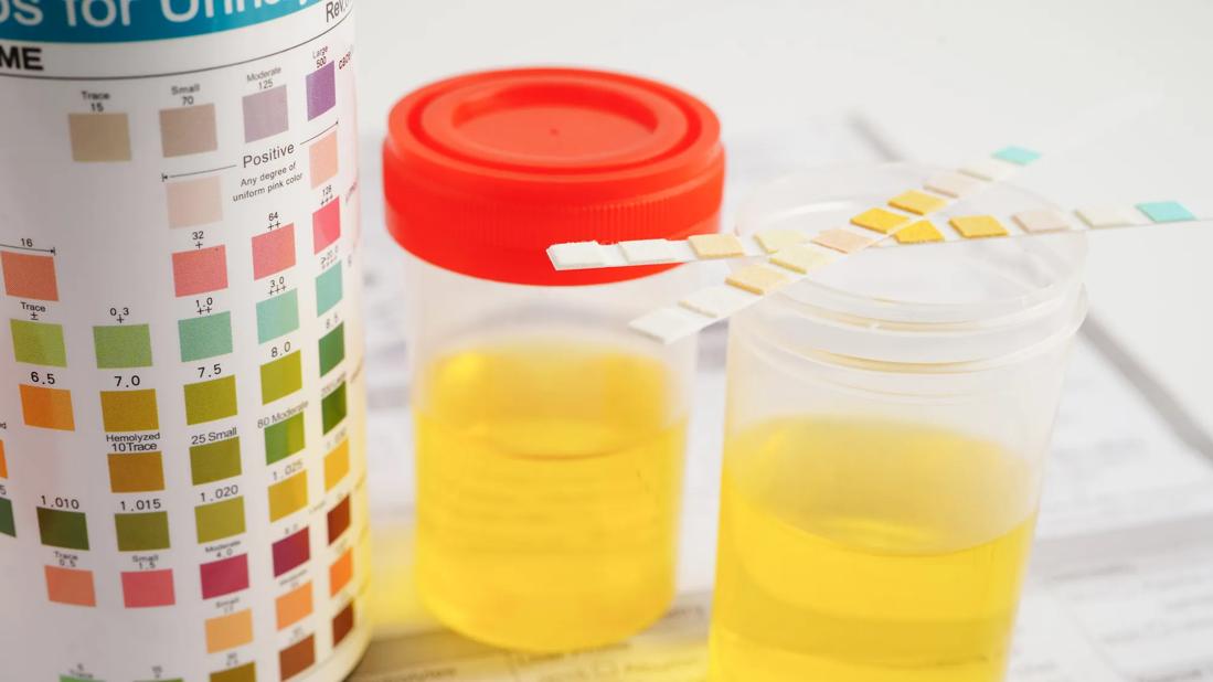 An FSH at home urine test kit