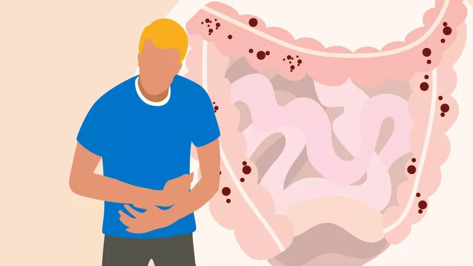 Person clutching stomach, with over-sized digestive track in background