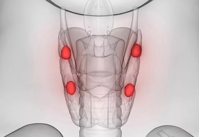 Parathyroids