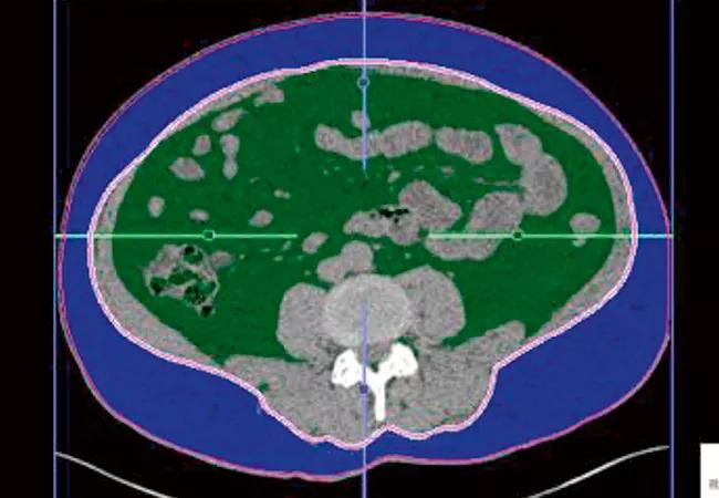 650&#215;450 Noncontrast CT Scans for Kidney Stones