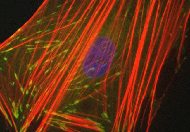 Human lung myofibroblast