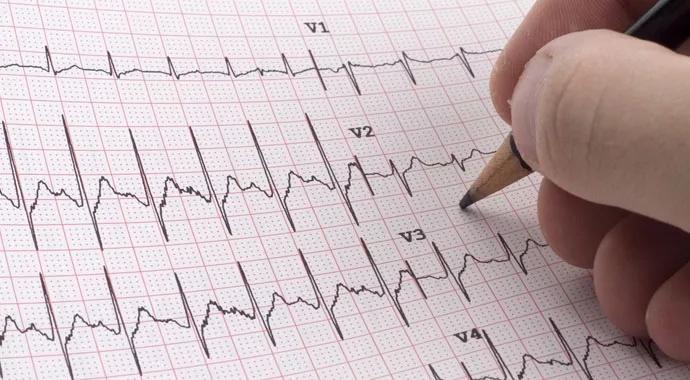 First-Line Ablation Works for Atrial Fibrillation Patients