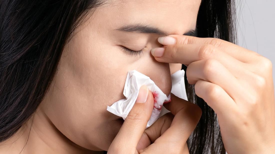 woman with nose bleed