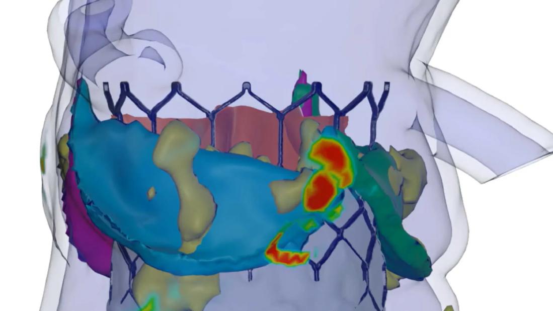 heart-simulation