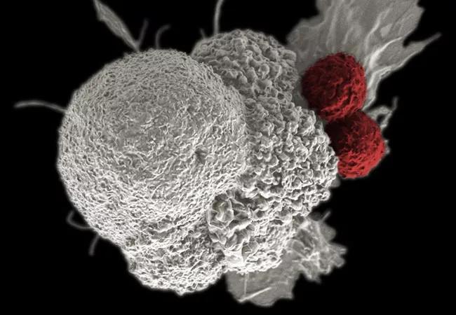 Cancer immunotherapy. Source: National Cancer Institute.