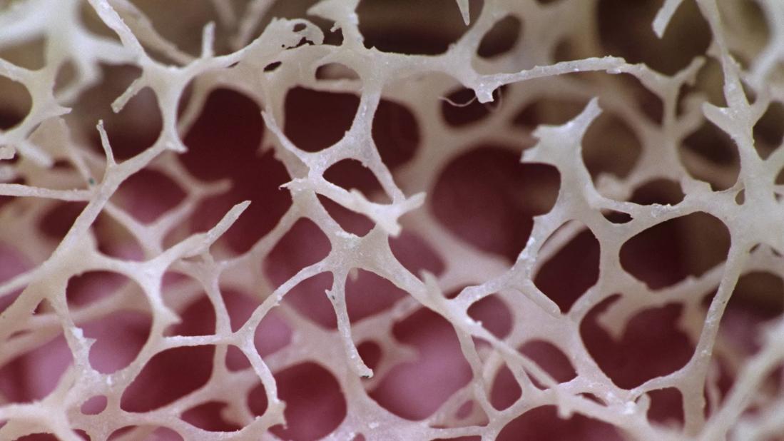 Closeup of bone marrow