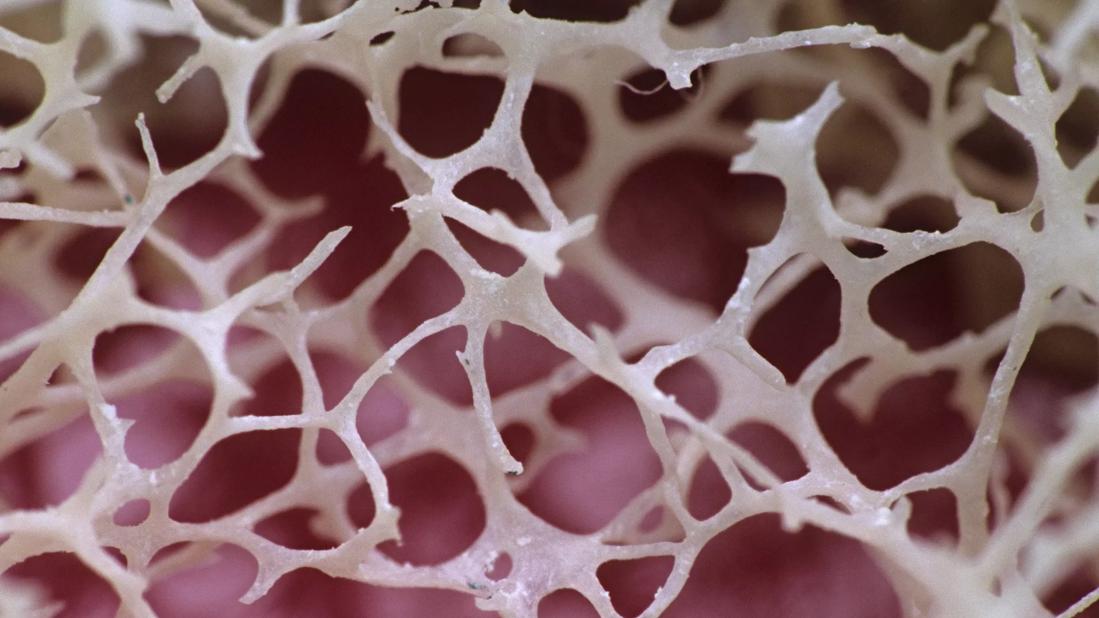 Closeup of bone marrow