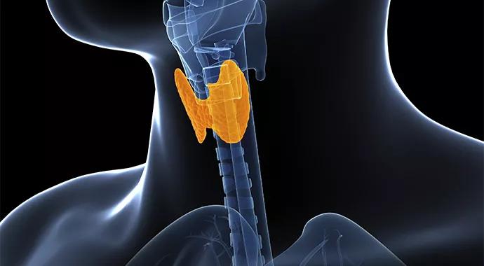 hyperthyroidism-690&#215;380