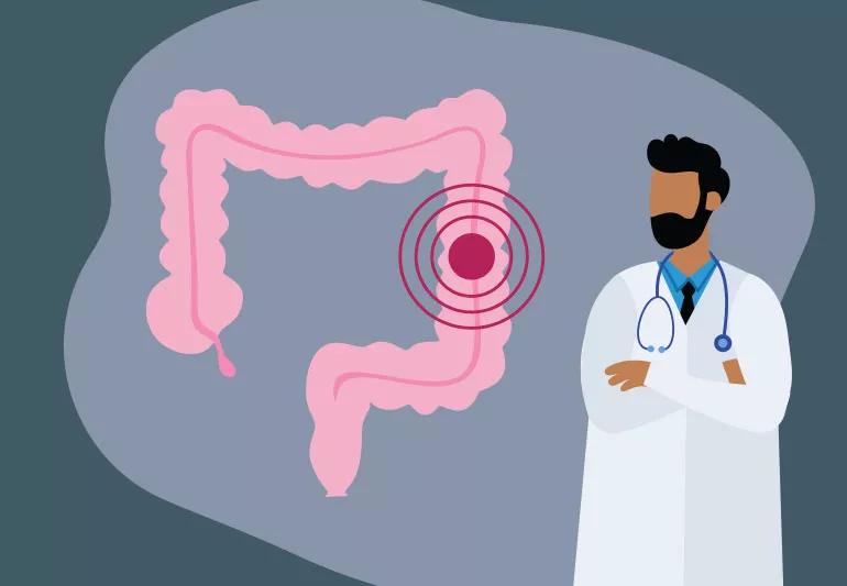 colon cancer screenings