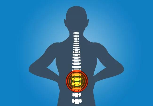 Illustration showing back pain