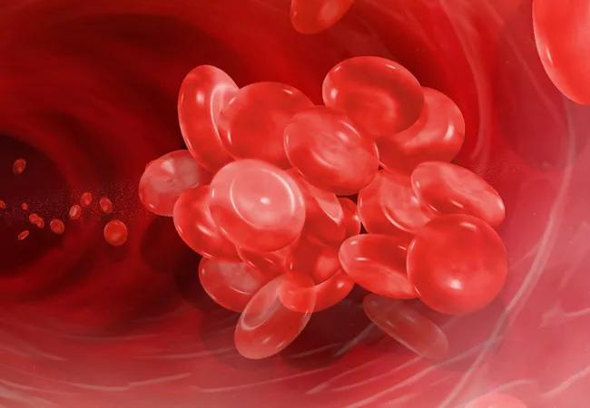 thrombosis/blood clotting