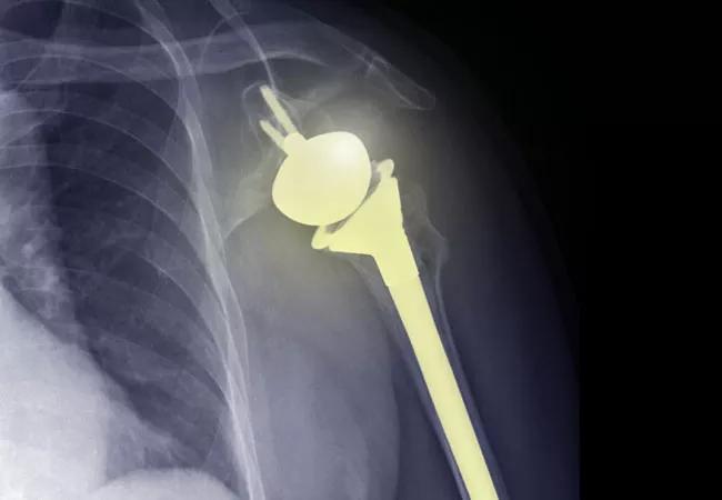 shoulder pain
