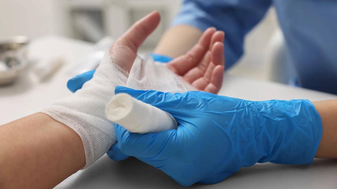 Hand being wrapped in gauze by healthcare provider wearing disposable medical gloves