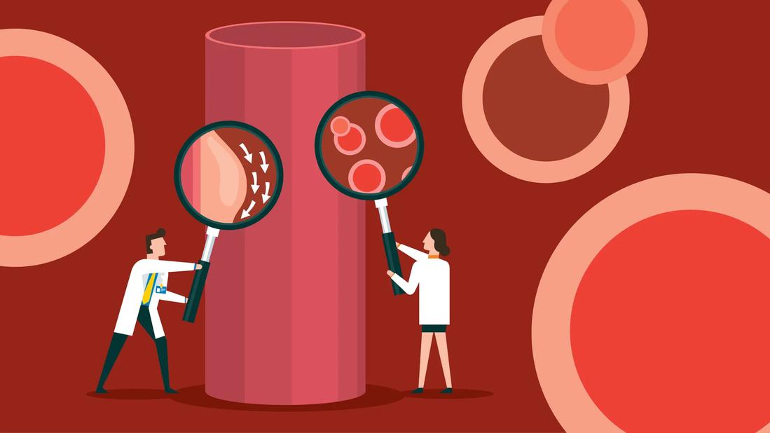 HDL vs. LDL: What’s the Difference?