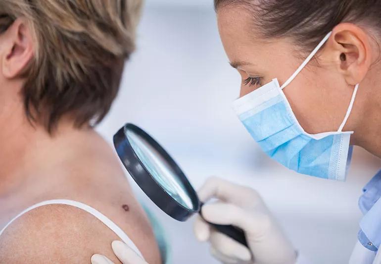 provider examines mole on patient's back using a magnifying glass