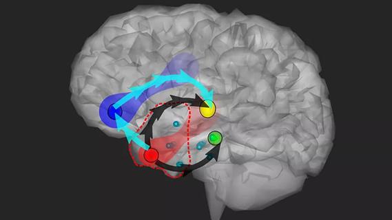 schematic view of brain connections during an epileptic seizure