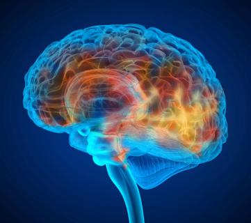 22-NEU-3482371 Alzheimers-brain-650&#215;450