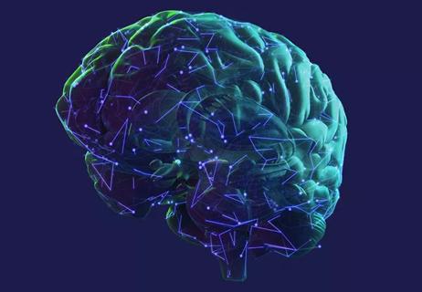 illustration of brain with Parkinson's disease