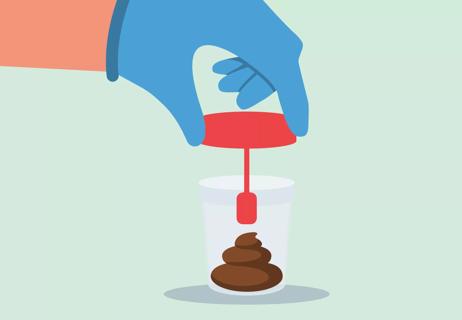 An illustration of a gloved hand putting a lid on a stool sample