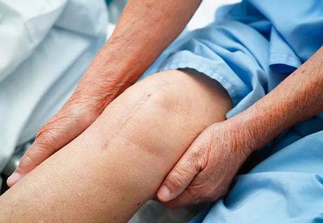 Asian elderly woman patient with scar knee replacement surgery in hospital.