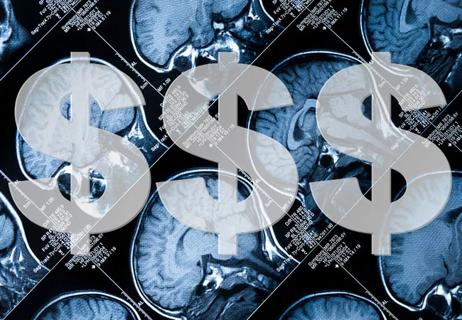 cost-effectiveness of epilepsy surgery
