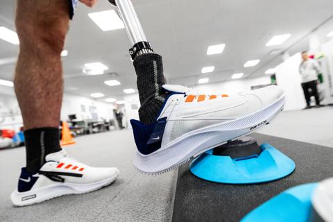 Prosthetic leg